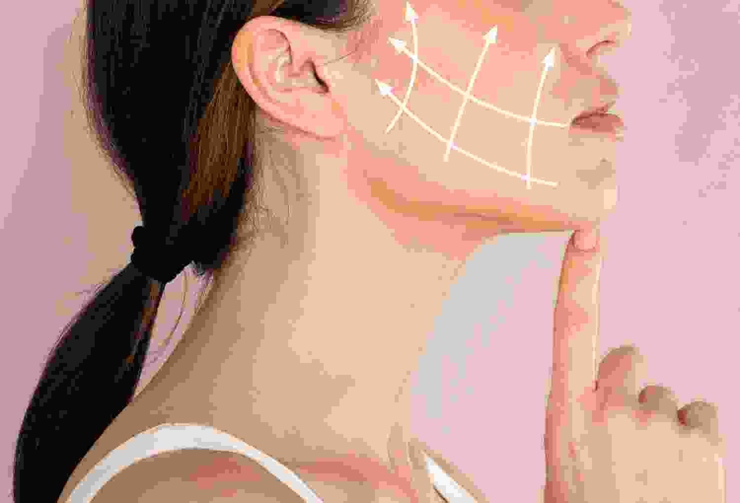 Cheek Augmentation Cheek Augmentation